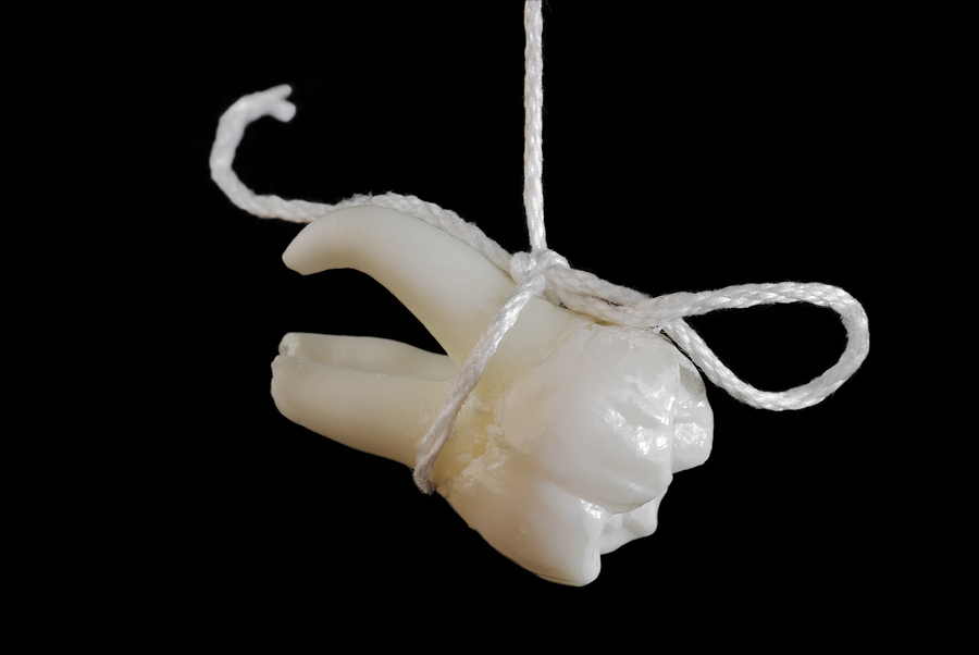 Unveiling the Benefits of Wisdom Teeth Extractions
