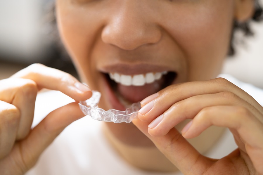 The Ultimate Guide to Transforming Your Smile with Invisalign