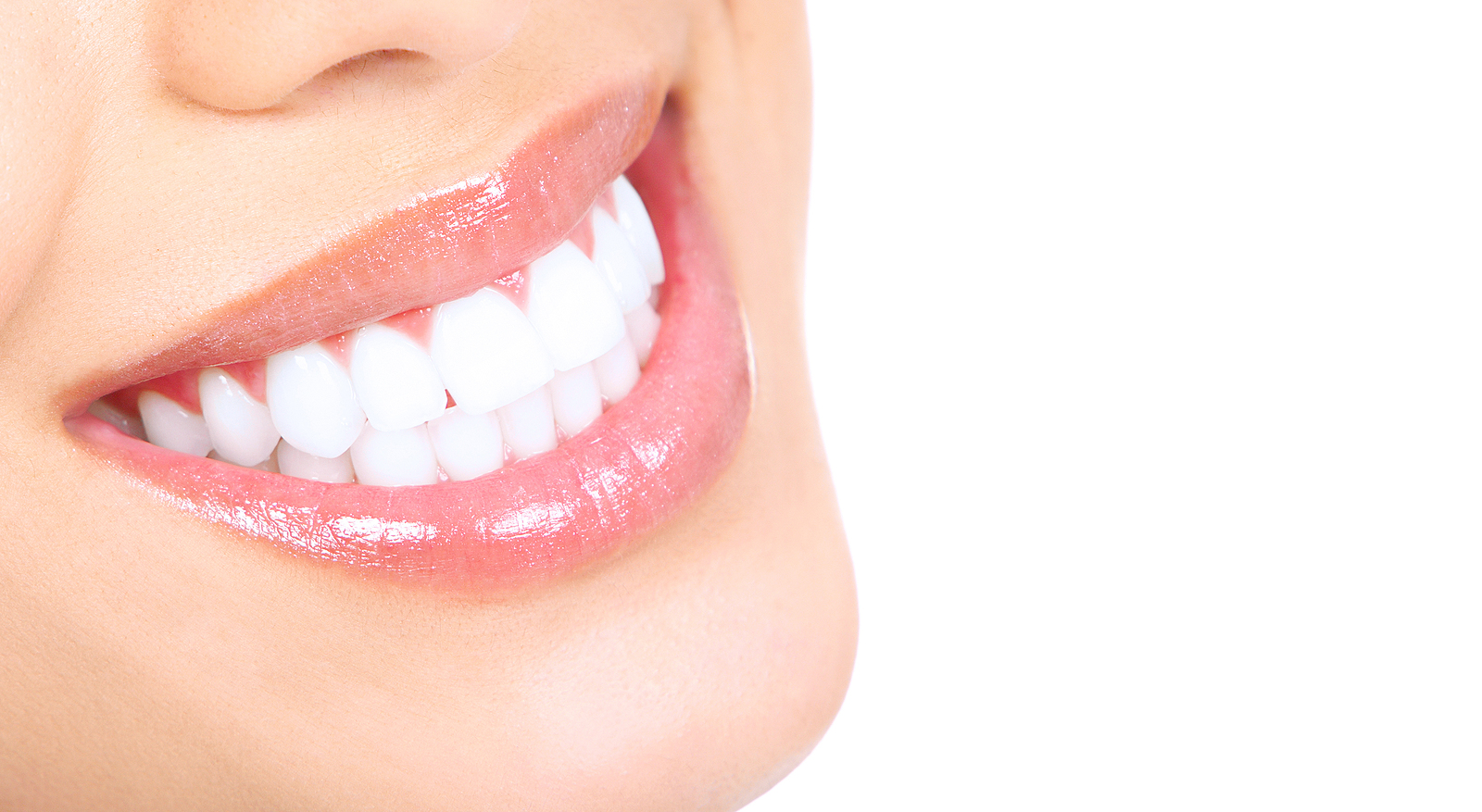 3 Reasons You Need Teeth Whitening