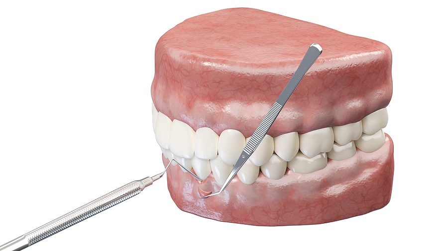 Restore Your Smile with Gum Grafting in Mountain View, CA